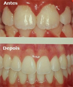 Periodontia