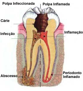 Endodontia