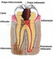 Endodontia